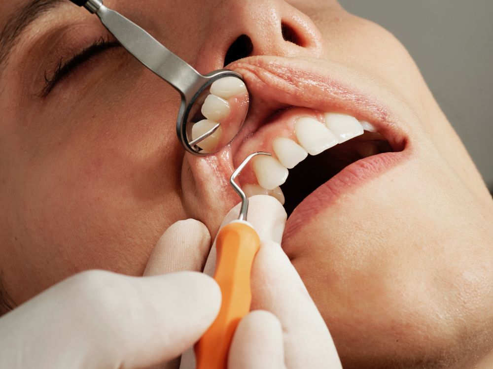 Tandlægelån til tandlægeregning
